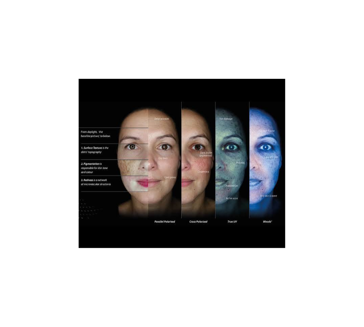 Análisis facial con distintos tipos de luz para observar la superficie y las capas de la piel